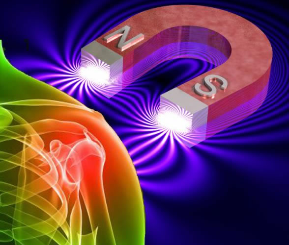 Información Rápida para Terapia Magnética