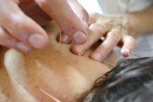 Descubre todo sobre Meridiano de Acupuntura