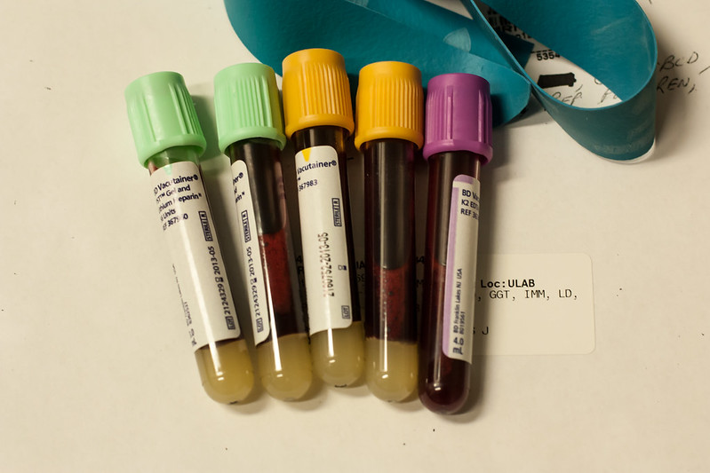 Información Rápida para Autohemoterapia