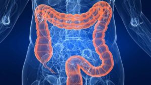 Descubre todo sobre Hidroterapia de Colon