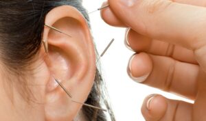 Descubre todo sobre Puntos de Auriculoterapia: ¿Qué son y para qué sirven?